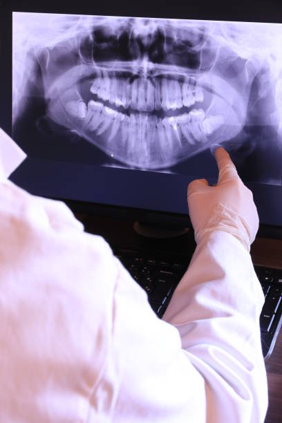 Best Urgent Care for Lost Fillings or Crowns in Corning, NY